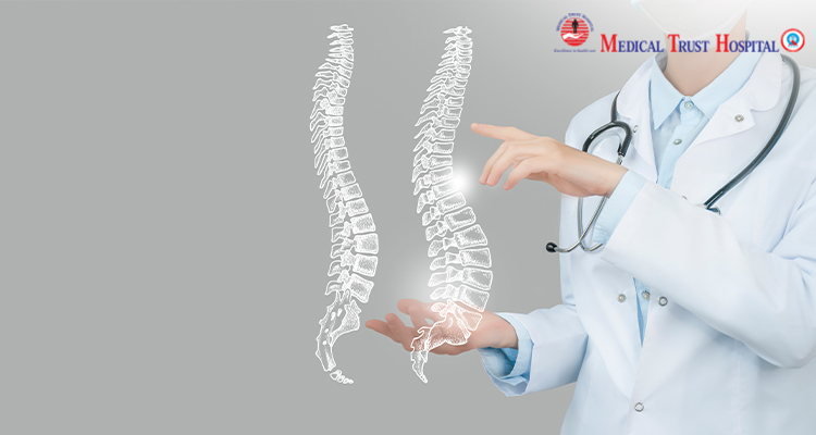 Scoliosis treatment in kochi | Medical trust